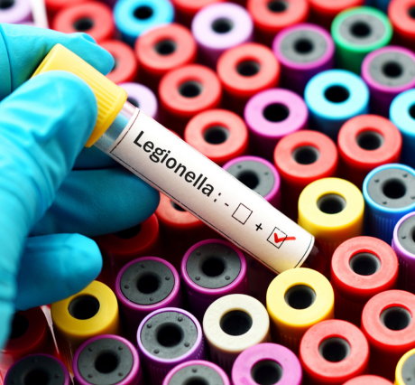 Legionella bacteria test tube